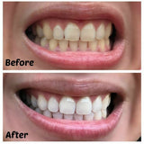 Simplyy Smile's Organic Activated Charcoal Teeth Whitening