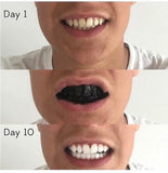 Simplyy Smile's Organic Activated Charcoal Teeth Whitening